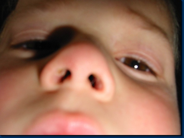 600x450 pixels (56,7K)